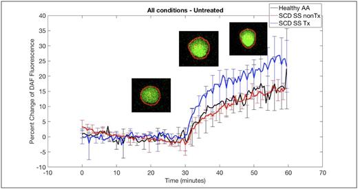 Figure 1. Response of RBC NO related fluorescence to shear stress