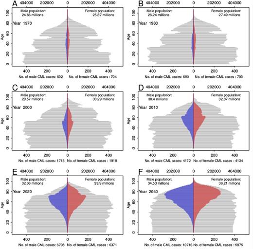 Figure 1. Estimated number of CML patients by single age and sex, corresponding legal or projected population (and period specific relative survival hypothesis) in france in 1970 (A), 1980 (B), 2000 (C), 2010 (D), 2020 (E) and 2040 (F).