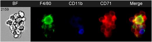 Figure 1. Representative image of an erythroblastic island harvested from murine bone marrow stained with F4/80-AF488 (green), CD11b-PE (blue), and CD71-BV421 (red) and analyzed by imaging flow cytometry.
