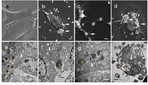 Figure 1. Phagocytosis of platelets by endothelial cells in vitro.