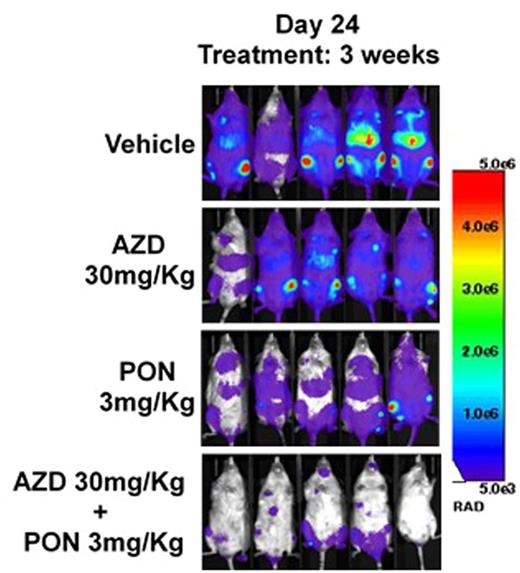 Figure 1. Combination treatment of AZD1208 and Ponatinib in H-SB2-luc xenograft model, significantly suppressed leukemia burden as compared with vehicle-treated group.