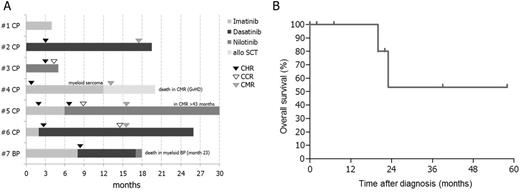 Figure. (A) responses and (B) overall survival in 7 patients with ETV6-ABL1 positive MPN-eo treated with various tyrosine kinase inhibitors.Abbreviation, CHR:complete hematologic response; CCR: complete cytogenetic response; CMR: complete molecular response; CP: chronic phase; BP: blast phase; allo SCT: allogeneic stem cell transplantation.