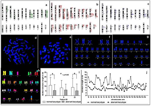 Figure 1. a-b) Results of the Cytogenetic Data Analysis System (CyDAS) evaluation of all integratedkaryotypicdata from R-banding,iFISHandmFISHanalyses for recurrent gains and losses (a) as well as for recurrent breakpoints (b). / c-f) T/C FISH on metaphases (d,e) and T/C FISHkaryograms(f,g) of patient 46 with a complex karyotype. Depicted are a normal cell (d and f) and an aberrant cell (e and f) The fluorescence intensity correlating with telomere length is higher in the normal cell than in the aberrant cell indicating telomere shortening in the aberrant cell. / g)Karyogramof patient 46 aftermulticolorfluorescence in situ hybridization (mFISH) demonstrating a complex karyotype with cryptic aberrations. / h) Median telomere lengths (kilobases) of normal and aberrant metaphases in three patients with CLL.*statistically significant difference (p<0.05). / i) Average telomere length (kilobases) of each chromosome arm of normal and aberrant metaphases of one patient.