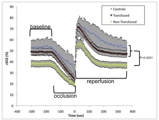Figure 2. NIRS repsonse to forearm occlusion.