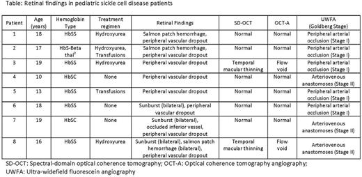Retinal findings in pediatric sickle cell disease patients. / SD-OCT: Spectral-domain optical coherence tomography; OCT-A: Optical coherence tomography angiography; UWFA: Ultra-widefield fluorescein angiography.