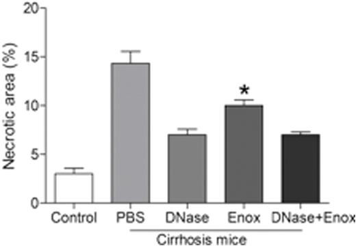 Figure 2. The necrotic area of liver tissue in control mice, cirrhotic mice treated with PBS, DNase I, enoxaparin or a combination of DNase I with enoxaparin. Enox, Enoxaparin. *p < 0.05 vs. PBS