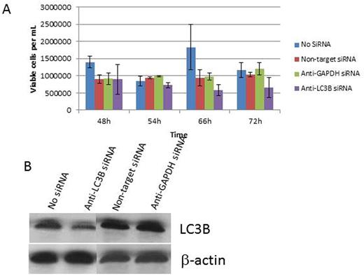 Figure. A: Graph showing decreased cell viability and increased chemosensitivity in the anti-LC3B siRNA-treated HEL-Luc cells. This effect is not as pronounced in the control groups, and is most pronounced after the 48h time point. / B: Western blot showing LC3B protein knockdown compared to control groups
