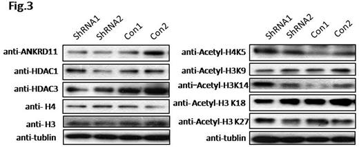 Changes of histone acetylation in ANKRD11-KD cell line (MEG-01). ANKRD11 KD significantly increased acetylation of histones H3 and H4 at H3K14 and H4K5.