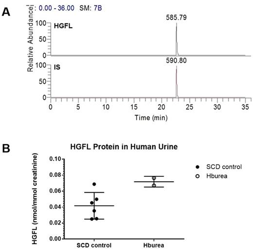 Figure 1. HR/SIM analysis of HGFL peptide in human urine. (A)The ion peaks of HGFL peptide m/z 585.79 and internal standard (IS) m/z 590.80 were chosen for the high resolution/selective ion monitoring (HR/SIM) analysis using LTQ Orbitrap XL™ mass spectrometer. Extracted ion chromatograms (EICs) were based on a ±0.01 Da mass extraction window (MEW) centered on the theoretical m/z. (B) SCD patients at risk for developing renal disease based on the presence of hemoglobinuria showed significantly increased HGFL levels (1.72-fold, p=0.015).