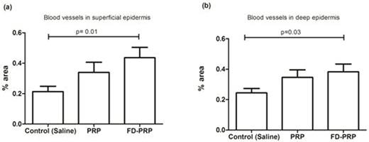 Figure. Quantification of blood vessels through imunohistochemistry using smooth α-actin and treated by Image J software; A) Superficial epidermis; B) Deep epidermis.