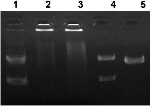 Figure 1. Daunorubicin (DNR) as a drug for leukemia treatment. Inhibition on topoisomerase II activity with DNR. Decatenated kDNA was incubated with nuclear extracts from Reh treated with DNR (0, 0.02 and 0.05 mg/ml) and compared with linearized kDNA.
