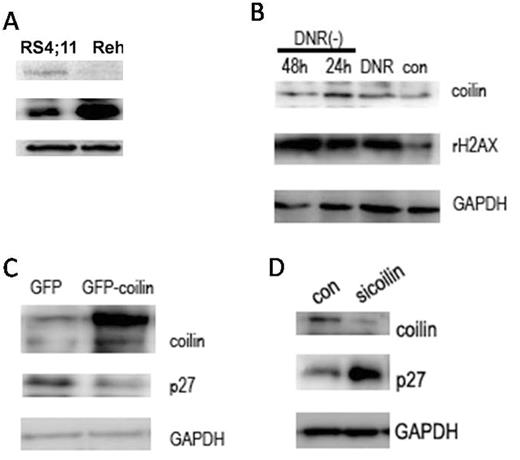 Figure 3. Coilin regulated the expression of p27. / (A)The expression of coilin was higher in RS4;11 cells than that in Reh cells, whereas p27 had the opposite expression pattern in the two cells.(B)The level of coilin increased when cells were treated with DNR.(C,D)The over-expression of coilin inhibited p27 expression and coilin knock-down increased the expression of p27.