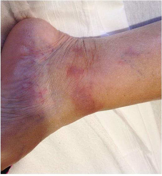 Figure 1. Left ankle