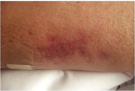 Figure 2. Right Calf