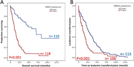 Figure 3. Overall survival (A) and leukemic transformation (B) of 228 MDS patient with higher expression versus lower expression of DOCK1