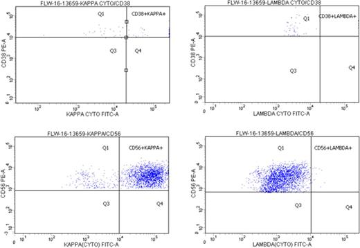 Figure 1. Flow cytometry showing near-absence of CD38-bright elements in the marrow of patient A (top panels). Gating on CD56-positive cells in the same sample reveals a kappa light chain-restricted plasma cell population (bottom panels).