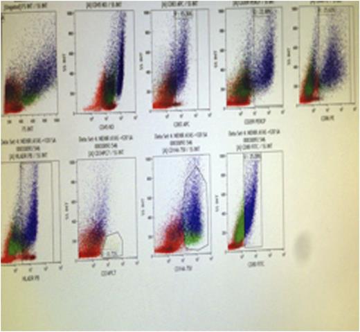 Figure. Mature dendritic cells (CD83+)