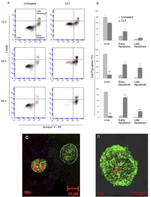 Figure 2. Flow cytometry analysis of Annexin V-PE/7-AAD stained U266 cells treated with 10 µM CLF. A) Representative dot plots of Annexin V-PE vs 7-AAD signals gated as live, early apoptotic and late apoptotic quadrants B) Cell population bar graphs of corresponding dot plot quadrants (n=3). C) Early apoptotic U266 cell (right) stained with Annexin V-PE (green) and a late apoptotic U266 cell (left) stained with both Annexin V-PE (green) and nuclear dye PI (red) D) Close-up micrograph (160X) of a late apoptotic U266 cell.
