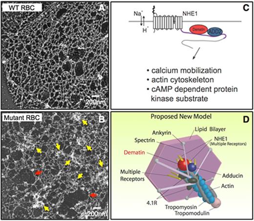 Figure 1. Dematin and adducin link erythrocyte junctional complex to membrane via multiple receptors. A, WT RBC cytoskeleton. B, Mutant (DAKO) RBC cytoskeleton. Images show a grossly deranged membrane skeleton in DAKO as compared to wild type. Red arrows show enlarged pores and yellow arrows indicate the presence of aggregates. Bars correspond to 0.2 µM. C, Schematic diagram of dematin, adducin, and NHE1 linking the complex to multiple signaling pathways. D, Proposed new model of the erythrocyte junctional complex.