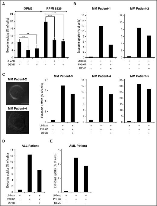 Figure 4. Caspase inhibition attenuates the uptake of L88 stroma cell–derived exosomes in hematological malignant cells. (A) Percentage of PKH67-positive OPM2 or RPMI cells after 3 hours of incubation with PKH67-labeled L88 cell–derived exosomes that were preincubated with zVAD.fmk or DEVD.fmk. (B) Percentage of MM patient-derived, PKH67-positive cells after 3 hours of incubation with PKH67-labeled L88 cell–derived exosomes, pretreated with the caspase-3 inhibitor z-DEVD.fmk (5 patient samples run in duplicate). (C) Representative confocal microscopy images of MM patient 2 and patient 4 positive cells upon incubation with PKH67-labeled L88 cell–derived exosomes (bar represents 4 µm). (D) Percentage of ALL patient-derived, PKH67-positive cells after 3 hours of incubation with PKH67-labeled L88 cell–derived exosomes, pretreated with the caspase-3 inhibitor DEVD.fmk (1 patient plasma sample, run in duplicate). (E) Percentage of acute myeloid leukemia (AML) patient-derived, PKH67-positive cells after 3 hours of incubation with PKH67-labeled L88 cell–derived exosomes, pretreated with the caspase-3 inhibitor DEVD.fmk (1 patient plasma sample, run in duplicate).
