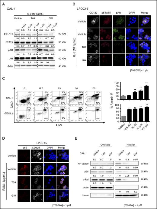 Figure 5. LXR activation in BPDCN cells interferes with IL-3–induced STAT5 and Akt phosphorylation, as well as NF-κB activation. (A) CAL-1 cells were treated with increasing concentrations (1 µM, 5 µM, or 10 µM) of LXR agonists (T09 or GW) for 24 hours, followed by 10 ng/mL of IL-3 for 30 minutes. Phospho-STAT5 (Y694), phospho-Akt (S473), as well as unphosphorylated corresponding protein expression was assessed by western blot. The expression of these proteins was compared with actin with the vehicle condition being considered as 1. Results of 1 representative experiment of 2. (B) BPDCN cells (LPDC #5) were treated with 1 µM LXR agonists for 24 hours. Phospho-STAT5 (Y694) and phospho-Akt (S473) were assessed by confocal microscopy after IL-3 stimulation (10 ng/mL, 30 minutes). Results of 1 representative sample (LPDC #5) of 3 BPDCN samples tested (LPDC #5, #6, #9). (C) CAL-1 and GEN2.2 cells were treated with increasing concentrations (12.5 µM, 25 µM, 50 µM, and 100 µM) of NF-κB inhibitor JSH23. Cell death was assessed by AnxV/7AAD staining, and analyzed by cytometry. Dot plots from 1 representative experiment of 5 and cumulative data from these 5 experiments expressed as percentage of dead AnxV+ cells are shown (left panel). Cumulative data from 3 experiments expressed as mean ± SEM are shown (right panel) (**P < .01, Mann-Whitney). (D) Primary BPDCN cells were treated with 1 µM of LXR agonists for 24 hours, followed by 1 µg/mL of R848 for 45 minutes. P65 phosphorylation (pS536) was assessed by confocal microscopy. Data from 1 representative primary BPDCN sample of 4 (LPDC #5, #6, #8, #9) are shown. (E) CAL-1 cells were treated with 1 µM T0901317 (T09) or GW3965 (GW) for 24 hours, followed by R848 (1 µg/mL) stimulation for 6 hours. Cytosolic and nuclear protein fractions were isolated as described in “Methods”. NF-κB1 (p105), p50, p65, and c-Rel proteins were analyzed by western blot and the expression of these proteins was compared with actin and lamin B expression (for cytosolic or nuclear expression, respectively) with the vehicle condition being considered as 1. Results from 1 representative experiment of 3.