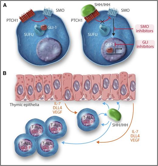 (A) A very simplified scheme of the hedgehog signaling pathway. (Left) In the absence of ligand the Patched (PTCH1) receptor inhibits the activity of the smoothened (SMO) transmembrane protein. The GLI-1 (and GLI-2) transcription factor is kept in the cytosol by Suppressor of Fused (SUFU) and other proteins. (Right) Upon binding of hedgehog ligands, either SHH or IHH, to PTCH1, the inhibitory activity on SMO is relieved. Signaling downstream to SMO releases GLI-1 that translocases into the nucleus, binds to DNA, and regulates the expression of hedgehog target genes. (B) Proposed mechanisms of the positive effects of hedgehog ligands on T-ALL. Approximately 20% of T-ALLs secrete either SHH and IHH. These cytokines have both autocrine and paracrine effects. They bind to T-ALL cells and activate the hedgehog pathway, resulting in activation of GLI-1 and consequent upregulation of prosurvival and growth genes. In addition, SHH/IHH bind to thymic epithelium cells and induce the expression of T-ALL–promoting proteins such as the Notch ligand DLL4, interleukin 7 (IL-7), and vascular endothelial growth factor (VEGF).
