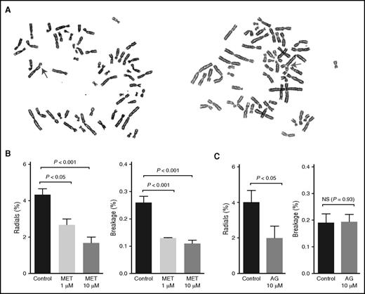 Figure 4. Metformin prevents FA patient–derived cells from developing radials and chromosomal breaks. (A) Representative pictures of spontaneous radials and breaks in PD259i human FA-A fibroblasts. The arrows indicate a chromosomal break (left) or a radial (right). (B-C) Statistical quantitation of radials and breaks in PD259i human FA-A fibroblasts after aminoguanidine or metformin treatment. PD259i cells were maintained in DMEM supplemented with 10% fetal bovine serum and penicillin/streptomycin. Cells were cultured with metformin or aminoguanidine for 48 hours before metaphase spreads were made. Fifty metaphases for each sample were scored for radial contents and chromosomal breakage. Data are combined results from 6 independent experiments. AG, aminoguanidine.