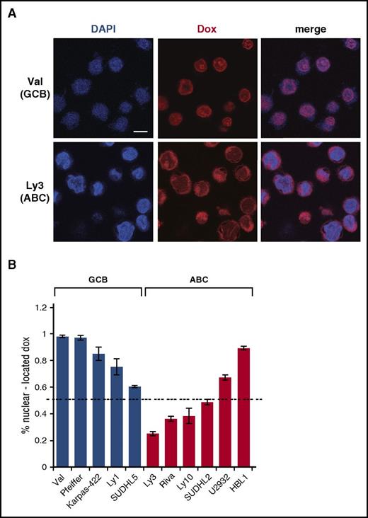 Figure 2. Dox is often enriched in the cytoplasm in ABC-DLBCL cell lines. (A) Subcellular distribution of Dox in representative GCB (Val) and ABC (Ly3) cell lines, as assessed by confocal microscopy after treating cells with IC50 concentrations of Dox for 24 hours. Scale bar, 10 μM. Quantification of the confocal microscopy data from 4 GCB and 5 ABC cell lines is summarized in (B). Error bars indicate SD from measurements of multiple cells (see supplemental Methods for details). Dotted horizontal line marks the 50% level of nuclear Dox enrichment.