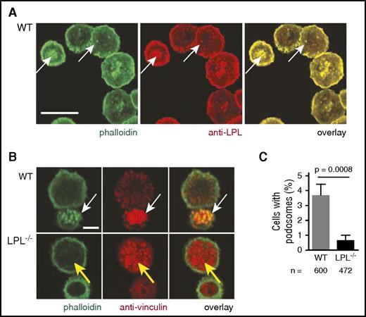 Figure 7. LPL is essential for alveolar macrophage podosome formation. (A) Alveolar macrophages from adult WT mice were applied to glass coverslips and fixed. F-actin was illuminated by staining with phalloidin-AlexaFluor 488 (green), and LPL was labeled with anti-LPL mAb followed by DyLight594 (red). LPL colocalizes with F-actin in podosomes (white arrows). Scale bar shows 20 μM. (B) Confocal image analysis demonstrating podosome formation in alveolar macrophages from adult WT animals (white arrow) with a podosome defined as an actin dot (green) surrounded by anti-vinculin staining (red). Podosomes did not form well, if at all, in alveolar macrophages from adult LPL−/− mice (yellow arrow). Scale bar shows 5 μM. (C) Percentage of alveolar macrophages with podosomes from adult WT (gray bar) or LPL−/− (black bar) mice. Data from 3 independent experiments combined; the standard errors of the mean of the proportions are shown and were calculated using the formula standard error = √(p*(1 − p)/n), where p represents proportion and n represents the number of samples; P value was determined using Fisher’s exact test.