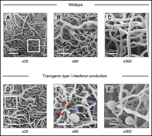 Figure 5. Abnormal morphology of cerebral microvascular casts of IFNHigh mice demonstrated by scanning electron microscopy. (A-C) Scanning electron micrograph of cerebral microvascular casts of wild-type mice at low (×25), medium (×80), and high power (×300). (D-F) Transgenic type I IFN production: Abnormal microvascular morphology in IFNHigh mice, with variations in microvessel caliber (red arrows), ectatic vessels, and microaneurysms (blue arrows). Such microvascular abnormalities were observed in all IFNHigh mice with highest levels of brain-restricted IFN-α1 production (n = 6) but not in WT mice.