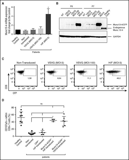 Figure 1. In vitro restoration of Munc13-4 expression and cytotoxic function after gene transfer into Munc13-4–deficient T cells. (A) The level of Munc13-4 mRNA expression was 4.4 to 5.5 times higher in the patients’ H/F-LV-bulk–transduced cells than in healthy controls and nontransduced FHL3 cells, and was 1.5 times higher in VSVG-LV–transduced cells (MOI, 100) than in nontransduced cells. The experiments were performed on 3 different FHL3 samples (P5, P6, and P7). The data were normalized against GAPDH and are expressed as a fold-change relative to healthy control T cells. It is noteworthy that mRNA levels were similar in nontransduced patient cells and healthy control cells. (B) Munc13-4 protein expression 6 days after transduction (in the same 3 samples as described for panel A; only P6 and P7 are presented here). (C) Dot plots represent (for CD8+ gated cells) the number of Munc13-4/CFP+ cells as a percentage of the CD8+ population 6 days after transduction with H/F-LV at an MOI of 5 or with VSVG-LV at MOIs of 5 and 100; 1 representative experiment of 3 (same samples as in panel A) is shown. (D) The number of CD107a/b+ cells as a percentage of the CD8+ T-cell population after stimulation with 30 µg/mL anti-CD3. In transduced samples, the percentage of CD107a/b+ cells are presented with respect to CFP+ or Munc13-4/CFP+ gated cells. n = 7 different FHL3 samples for nontransduced cells (P1-P7); n = 5 for H/F-CFP as control (P3-P7); n = 3 for H/F (P5-P7); n = 6 for VSVG experiments (P1-P3, P5-P7). Data are presented as the mean ± standard deviation (SD). P values were calculated using an unpaired Student t test for mRNA expression and a 2-sided Mann-Whitney test for CD107a/b surface expression in the degranulation assay. *P < .05. GAPDH, glyceraldehyde-3-phosphate dehydrogenase; ns, nonsignificant; NT, nontransduced.