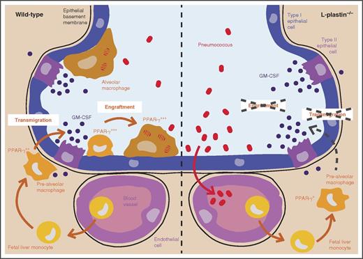 Fetal liver monocytes seed the lungs between embryonic day 14.5 and birth.2 These cells then differentiate into prealveolar macrophages and acquire PPAR-γ expression through GM-CSFR signaling.3 These prealveolar macrophages then translocate and engraft into the alveolar space in the first week of life, where they develop into terminally differentiated alveolar macrophages. In LPL-deficient mice, the translocation and the engraftment into the alveolar space are impaired (compare left and right panel), resulting in a severe reduction in number of alveolar macrophages and in an increased susceptibility to pneumococcal infection.