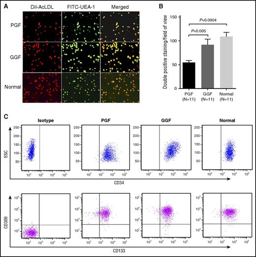 Figure 1. Characterization of cultivated BM EPCs. (A) Representative images for cultivated BM EPCs at day 7 in culture among subjects with PGF and GGF and normal controls (Normal). Typical BM EPCs were characterized by double positive staining (merged in yellow) with both DiI-AcLDL (red) and FITC-UEA-I (green) (original magnification ×20). (B) Quantification of double positive staining cells (merged in yellow) with both DiI-AcLDL (red) and FITC-UEA-I (green) at day 7 in culture among the PGF, GGF, and normal control groups (original magnification ×10). Data are expressed as the mean ± SEM. (C) The typical EPCs phenotype of cultivated BM EPCs was confirmed by demonstrating the similar expression of CD34, CD309, and CD133 at day 7 in culture by flow cytometry among subjects with PGF, subjects with GGF, and normal controls. Aliquots of isotype-identical antibodies served as negative controls.