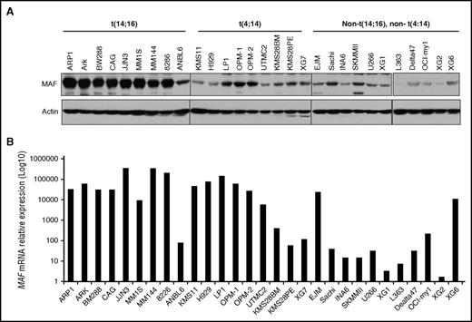 Figure 2. MAF protein was heterogeneously expressed and only partially correlated with mRNA levels in MM cells. Cell lysates were isolated from HMCLs harboring t(14;16), t(4;14), or cell lines without these translocations and resolved on 8% SDS-polyacrylamide gels. Protein was transferred to membranes and blotted with anti-MAF antibody using immunoblotting analysis (A). The level of MAF mRNA in HMCLs was determined by RT-qPCR (B).