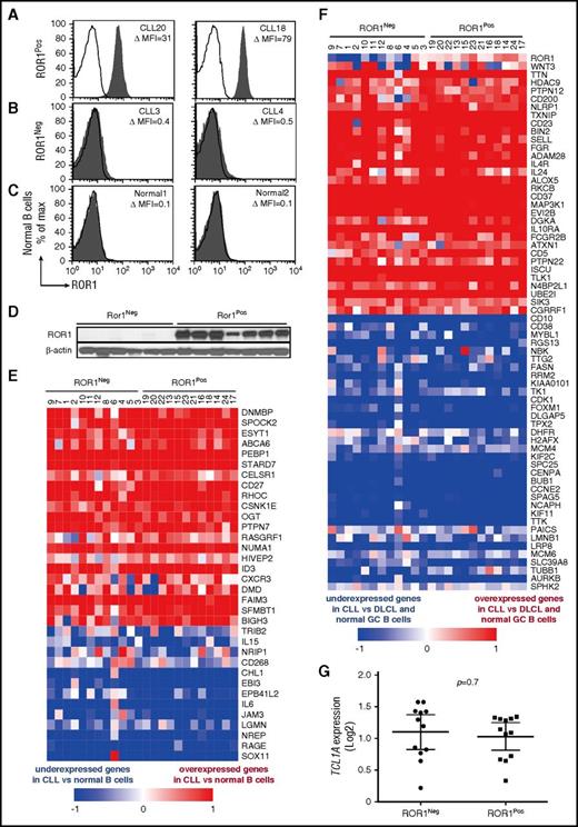 Figure 1. Expression of CLL signature genes by ROR1Neg or ROR1Pos CLL cells. Representative histograms depicting the fluorescence of CD19+ cells labeled with Alexa-647–conjugated 4A5 (anti-ROR1 mAb) (shaded histograms) or Alexa-647-conjugated nonspecific immunoglobulin G (IgG) of the same isotype (open histograms) for (A) ROR1Pos CLL B cells, (B) ROR1Neg CLL cells, or (C) representative normal blood B cells. The case identifier and the ROR1 ΔMFI are indicated at the top right corner of each panel. (D) Immunoblot analyses of whole cell lysates of ROR1Neg CLL or ROR1Pos CLL, as indicated at the top. Each lane represents a separate case. The membranes were probed with mAbs specific for ROR1 (top row) or β-actin (bottom row), as indicated on the left. (E-F) Each column represents a separate case of ROR1Neg or ROR1Pos CLL, as indicated at the top. The relative expression of the genes indicated on the right margin are provided in rows, using the color coding for log2 normalized effective count z scores as per the scale provided at the bottom of each heat map. (E) Heat map for 34 genes previously found expressed differentially by CLL cells vs normal B cells. (F) Heat map for 65 genes previously found expressed differentially by CLL cells vs diffuse large cell lymphoma (DLCL) cells or normal germinal center (GC) B cells. (G) Relative amount of TCL1A transcripts found in ROR1Neg or ROR1Pos CLL cases, as indicated at the bottom of the graph. Each dot represents the relative TCL1A of a separate case. The large horizontal bar indicates the mean level of TCL1A transcripts, and the 2 smaller horizontal bars show the 95% confidence interval.