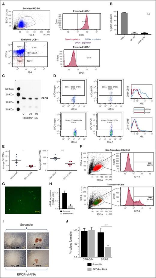 Figure 1. EPOR is expressed on a subset of UCB CD34+ cells and is enriched in the CD34+ CD38– population. (A) Representative flow cytometry data showing EPOR and CD34 expression on UCB CD34+-enriched cells with gating strategy. (B) The percentage of CD34+, EPOR+, and CD34+EPOR+ expression on enriched UCB cells from 5 units with high purity (90% or higher CD34+ cells) by flow cytometry. (C) EPOR expression in enriched cells from 3 UCB units by western blot. (D) Representative flow cytometry data showing EPOR expression on UCB CD34+ cell subsets CD34+CD38– and CD34+CD38–. (E) EPOR expression by cell percentage (left) and MFI (right) on UCB CD34+ subsets. (F) Verification of EPOR shRNA transfection efficiency of UCB CD34+ cells by determining the percentage of GFP+ cells. (G) Micrograph showing GFP-expressing UCB CD34+ cells post lentiviral infection, confirming expression of EPOR shRNAs. Fluorescent images were taken at room temperature using an Olympus IX71 inverted microscope and Olympus DP71 camera. DP controller was used for software acquisition and Adobe Photoshop was used for image processing (scale bar represents 50 µm). (H) mRNA in EPOR knocked down UCB CD34+ relative to control confirming depletion of EPOR by RNAi. (I) Micrographs show formation of hematopoietic cell colonies. Erythroid colonies are shown on the right side with EPOR-depleted UCB CD34+ colonies shown in the right lower corner. Bright field images were taken at room temperature using an Olympus IX71 inverted microscope, 10x objective lens, and Olympus DP71 camera. DP controller was used for software acquisition and Adobe Photoshop was used for image processing (scale bar represents 200 µm). (J) Quantitation of CFU-G/M vs BFU-E colonies with or without EPOR-depletion. Single (*) and double (**) asterisks indicate statistical significance. CFU-G/M, colony-forming units–granulocytes and macrophages.