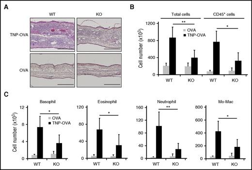 Figure 3. Cellular infiltration in the IgE-CAI skin lesion is decreased in mMCP-11–deficient mice. WT and KO mice were treated as in Figure 2 to induce IgE-CAI. (A) Photomicrographs show hematoxylin and eosin–stained specimens of IgE-CAI skin lesions on day 3 postchallenge. Scale bars, 200 μm. (B-C) Graphs show the numbers of cells of each indicated cell type that were isolated from the TNP-OVA–treated ear skin (black bars) or control OVA–treated ear skin (gray bars) on day 3 postchallenge (mean ± SD, n = 5 or 6 ears each). Data shown are representative of 3 independent experiments. *P < .05; **P < .01; Mo-Mac, monocytes/macrophages.