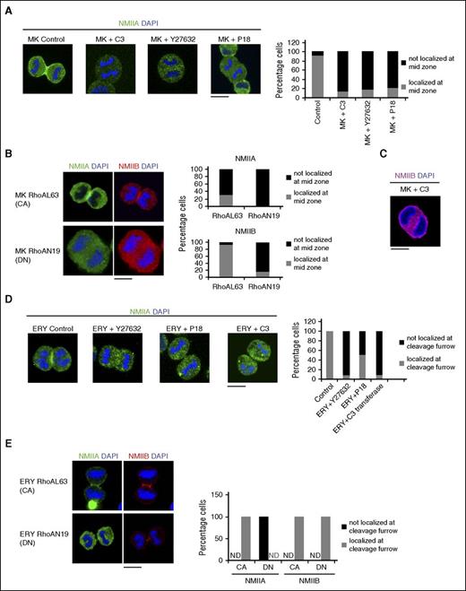 Figure 2. RhoA-dependent NMII isoform localization. (A) Representative confocal microscopy images of in vitro cultured control and inhibitor-treated MKs sorted on day 5 of culture on the expression of CD41a+CD42+ followed by treatment with the indicated inhibitors: (from left) control, C3 transferase (RHO inhibitor), Y27632 (ROCK inhibitor), or P18 (MLC kinase inhibitor). Cells were stained for NMIIB and costained with DAPI to indicate the mitotic cells. At least 3 independent samples were analyzed and the number of mitotic cells was counted for NMII localization. The corresponding histogram plot indicates the percentage of cells with NMIIB localization at the cleavage furrow. (B) A representative confocal image of MKs expressing constitutively active (CA) RhoA (RhoAL63) or dominant negative (DN) RhoA (RhoAN19). Cells were fixed and stained for NMIIA, NMIIB, and DAPI. At least 3 independent samples were analyzed and the number of mitotic cells was counted for NMII localization. The corresponding histogram plot indicates the percentage of cells with NMIIA and NMIIB localization at the cleavage furrow. (C) Representative confocal microscopy image of in vitro cultured MKs treated with exozyme C3 transferase. Cells were stained for NMIIB and costained with DAPI to indicate the nucleus. (D) Representative confocal microscopy images of day 9 in vitro cultured control and inhibitor treated ERYs: (from left) control, Y27632, P18, and C3 transferase. Cells were stained for NMIIA and costained with DAPI to indicate the mitotic cells. At least 3 independent samples were analyzed and the number of mitotic cells was counted for NMIIA localization. The corresponding histogram plot indicates the percentage of cells with NMIIA localizing at the cleavage furrow. (E) A representative confocal image of erythroblasts expressing CA RhoA (RhoAL63) or DN RhoA (RhoAN19). Cells were fixed and stained for NMIIA, NMIIB, and DAPI. At least 3 independent samples were analyzed and the number of mitotic cells was counted for NMII localization. The corresponding histogram plot indicates the percentage of cells with NMIIA and NMIIB localization at the cleavage furrow. ND, not detected. All bars represent 10 μm.