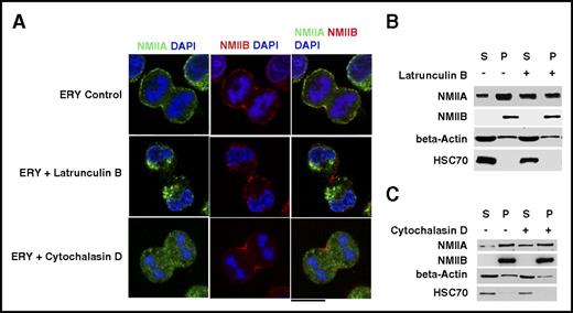 Figure 5. Actin network and NMII isoform localization. (A) Representative confocal microscopy images of in vitro–cultured day 9 control ERYs and ERYs treated with the indicated inhibitors. Cells were costained for NMIIA and NMIIB. DAPI was used to indicate the mitoticcells. Bar represents 10 μm. (B,C) Representative western blot of day 10 ERYs treated with/without cytochalasin D and latrunculin B. Cells were subjected to Triton X-100 fractionation and the soluble S and insoluble P fractions were probed for NMIIA, NMIIB, and β-actin. HSC70 was used as a loading control. The densitometric analysis of the blots is provided in supplemental Figure 16.