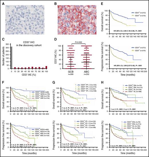 Figure 1. Expression and prognostic effect of CD37 antigen in patients with DLBCL. (A-B) Representative CD37− and CD37+ (red) IHC results (×60). Cell nuclei were counterstained with hematoxylin (blue). Images were obtained with an Olympus AX70 microscope with a DP71 camera. (C) Histogram of CD37 IHC scores in the DLBCL discovery cohort. (D) A scatter plot for CD37 expression in DLBCL and comparison between GCB and ABC cell of origin. (E) Patients with CD37− DLBCL had significantly worse OS and PFS compared with patients with CD37+ DLBCL, with a HR of 2.80 and 95% CI of 1.95 to 3.38 for OS, and a HR of 2.89 and 95% CI of 2.07 to 3.45 for PFS. (F-H) The adverse prognostic effect of CD37 loss was independent of GCB and ABC cell of origin, high and low IPI scores, and primary nodal (NL) and primary extranodal (ENL) origin.