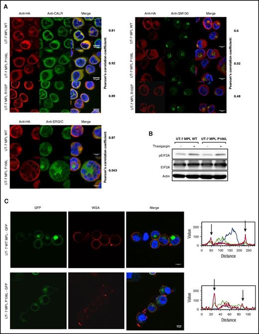 Figure 4. MPL P106L exhibits cellular trafficking defects without inducing ER stress. (A) Human MPL intracellular localization of UT-7 MPL WT and UT-7 MPL P106L: cells were stained with antibodies directed against the ER (anti-CALR), the Golgi apparatus (anti-GM130), the ER-Golgi intermediate compartment (anti-ERGIC), and MPL (anti-HA), and immunofluorescence was analyzed by confocal microscopy. (B) ER stress analysis: UT-7 MPL WT and P106L cells were treated with 1 μM thapsigargin for 30 minutes and analyzed by western blotting. (C) Localization of the murine MPL receptor fused to GFP: cells were transduced with the retroviral vector pREX-IRES-CD4-muMPLHA fused to GFP and directly analyzed without fixation by confocal microscopy. Wheat germ agglutinin served as membrane marker.