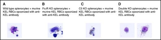 Figure 3. In vitro phagocytosis of antibody-coated KEL RBCs is observed in wild-type, FcγR KO, and C3 KO, but not FcγR KO × C3 KO (double-KO), splenocytes. Opsonized murine KEL RBCs were incubated in vitro for 15 minutes with splenocytes from (A) wild-type (C57BL/6) mice, (B) FcγR KO mice, (C) C3 KO mice, or (D) double-KO mice lacking FcγR and C3. Scanning was initially completed at low power, and then 30 high-power fields were evaluated in duplicate wells. The microscope used was an Olympus BX40, with an Olympus PLAN 100× objective and a numerical aperture of 1.25 under oil emersion. Images were captured using a SPOT Insight CCD camera (model 14.2) using SPOT basic software (version 4.7).
