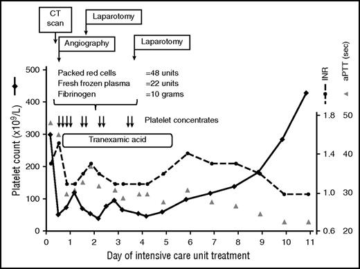 Figure 2. Thrombocytopenia in an ICU patient with multiple trauma. Transfusion of platelet concentrates (each containing 2-4 × 1011 platelets per unit) was part of the massive transfusion protocol. The platelet count returned to normal after the source of bleeding was controlled using surgical and interventional measures. CT, computed tomography; INR, international normalized ratio; sec, seconds.