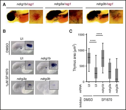 Figure 1. ndrg1b overexpression can restore rag1 expression in zebrafish treated with the PTEN inhibitor SF1670. (A) Double WISH in 4.5-dpf embryos showing overlapping expression of indicated ndrgs (black) and rag1 (red). (B) rag1 expression in 4.5-dpf embryos in uninjected embryos (UI) treated with DMSO or 1 µM SF1670, and in SF1670-treated embryos overexpressing indicated ndrg mRNA at 200 pg per embryo. (C) Quantification of the thymus area in (B). Graph shows 3 independent experiments combined, n = 43 to 68 embryos per condition. ****P < .0001, 1-way analysis of variance (ANOVA).