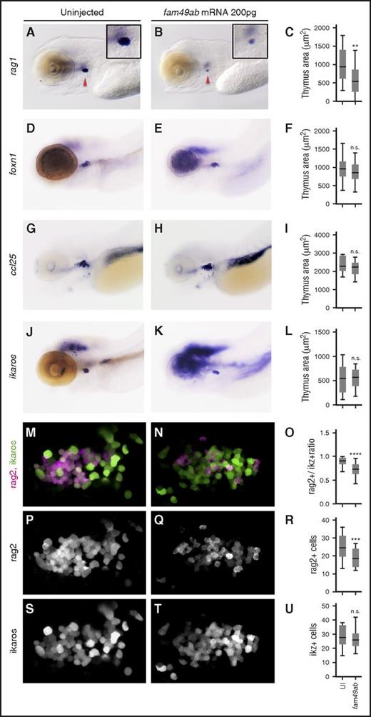 Figure 3. fam49ab overexpression inhibits thymocyte differentiation but not the arrival of early thymic progenitors. (A-C) Embryos injected with fam49ab mRNA display reduced rag1 expression at 4.5 dpf (red arrowheads); however, the expression of (D-F) ikaros, (G-I) foxn1, and (J-L) ccl25 is unchanged. (C,F,I,L) Plotted measurements of the thymus area in squared micrometers, n = 29 to 52 embryos per condition. (M-N,P-Q,S-T) Confocal images of (rag2:dsRed; ikaros:GFP) 4.5-dpf fish uninjected or injected with 200 pg of fam49ab mRNA. Images are maximum intensity projections of 5 optical sections covering a depth of field of 15 µm. (O,R,U) Ratio of rag2+ cells to ikaros+ cells, total number of rag2+ cells, and total number of ikaros+ cells, respectively. n.s., not significant. **P < .01; ***P < .001; ****P < .0001, Student t test.