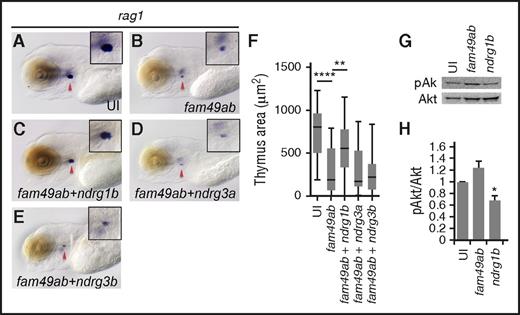 Figure 4. ndrg1a and ndrg1b can rescue thymus size in fam49ab overexpressing embryos. (A-B) rag1 expression at 4.5 dpf is reduced in embryos injected with fam49ab mRNA. (C) rag1 expression is partially restored in embryos injected with fam49ab mRNA together with ndrg1b mRNA. (D-E) Coinjection of ndrg3a or ndrg3b together with fam49ab does not rescue rag1 expression. (F) Plotted thymus area measurements from 3 independent experiments combined, n = 57 to 73 embryos per condition. **P < .01; ****P < .0001, 1-way ANOVA. (G) Representative western blot of pools of embryos injected with 200 pg of indicated mRNA, lysed at 2 dpf, detecting pAkt and Akt. (H) Densitometric analysis of (G), 3 experiments combined. *P < .05, 1-way ANOVA.