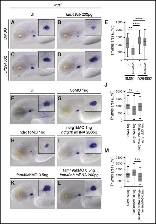 Figure 5. PI3K inhibitor rescues rag1 expression. Morpholinos against fam49ab and ndrg1b can also affect thymus size. (A-D) rag1 expression in 4.5-dpf embryos treated with DMSO or 10 µM LY294002, and either uninjected or injected with 200 pg of fam49ab mRNA. (E) Plotted thymus area measurements from 3 independent experiments combined. n = 37 to 61 embryos per condition. (F-M) rag1 expression in 4.5-dpf embryos treated with indicated MOs and MOs together with mRNAs. (J) Quantification of (G-I), 3 independent experiments combined. n = 30 to 57 embryos per condition. (M) Quantification of (G-I), 3 independent experiments combined. n = 30 to 44 embryos per condition. *P < .05; **P < .01; ***P < .001; ****P < .0001, 1-way ANOVA. CoMO, control morpholino oligonucleotide.