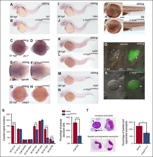 Figure 1. Neutrophil differentiation is severely impaired in c-mybhkz3/hkz3 mutants. (A-B) Loss of lyz expression in c-mybhkz3/hkz3 mutants. WISH of lyz in 36-hpf siblings (A) and c-mybhkz3/hkz3 mutants (B). (C-H) Myeloid progenitor, macrophage lineage, and neutrophil progenitor markers were not affected in c-mybhkz3/hkz3 mutants as evidenced by unaltered expression of pu.1 (C-D), apoeb (E-F), and cebp1 (G-H). (I-J) mpx+ cells were slightly decreased in c-mybhkz3/hkz3 mutants. WISH of mpx expression in 36-hpf siblings (I) and c-mybhkz3/hkz3 mutants (J). (K-L) Unaltered cybb expression in c-mybhkz3/hkz3 mutants. WISH of cybb expression in 36-hpf siblings (K) and c-mybhkz3/hkz3 mutants (L). (M-N) Decreased srgn expression in c-mybhkz3/hkz3 mutants. WISH of srgn expression in 36-hpf siblings (M) and c-mybhkz3/hkz3 mutants (N). (O-P) Decreased SB+ cells in c-mybhkz3/hkz3 mutants. SB staining in 36-hpf siblings (O) and c-mybhkz3/hkz3 mutants (P). (Q-R) In vivo imaging of 2-dpf Tg(mpx:GFP) embryos by VE DIC microscopy. Left panel, Bright-field DIC image; right panel, an overlay of bright-field DIC and fluorescent image. Blue arrowheads identify granules contained by neutrophils (white arrows) expressing GFP. (S) Quantifications of WISH, SB staining, and DIC analysis for panels A to R (Student t test, **P < .01, ***P < .001, ****P < .0001; WISH and SB, n ≥ 20; DIC, n ≥ 60). (T) May-Grünwald-Giemsa staining of neutrophils in 3-dpf embryos (left) and neutrophils were quantitated by morphology (right) (Student t test, *P < .05, n ≥ 500). Scale bars, 200 μm (O-P) and 5 μm (Q, R, T).