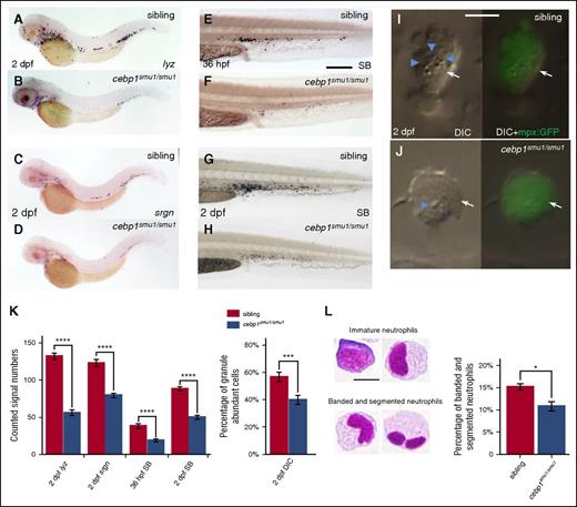 Figure 3. Neutrophil maturation is attenuated in cebp1smu1/smu1 mutants. (A-B) WISH of lyz expression in 2-dpf siblings and cebp1smu1/smu1 mutants. (C-D) WISH of srgn expression in 2-dpf siblings and cebp1smu1/smu1 mutants. (E-H) SB staining of 36-hpf (E-F) and 2-dpf (G-H) siblings and cebp1smu1/smu1 mutants. (I-J) In vivo VE DIC microscopy reveals scant granule in neutrophils in 2 dpf Tg(mpx:GFP);cebp1smu1/smu1 transgenic mutants (J) compared with siblings (I). Left panels, Bright-field DIC images; right panels, overlays of bright-field DIC images with corresponding GFP fluorescent images. Blue arrowheads identify granules contained by neutrophils (white arrows) expressing GFP. (K) Quantifications of WISH, SB staining, and DIC analysis (Student t test, ***P < .001, ****P < .0001; WISH and SB, n ≥ 23; DIC, n ≥ 56). (L) May-Grünwald-Giemsa staining of neutrophils in 3-dpf embryos (left) and neutrophils were quantitated by morphology (right) (Student t test, *P < .05, n ≥ 500). Scale bars, 200 μm (E-H) and 5 μm (I, J, L).