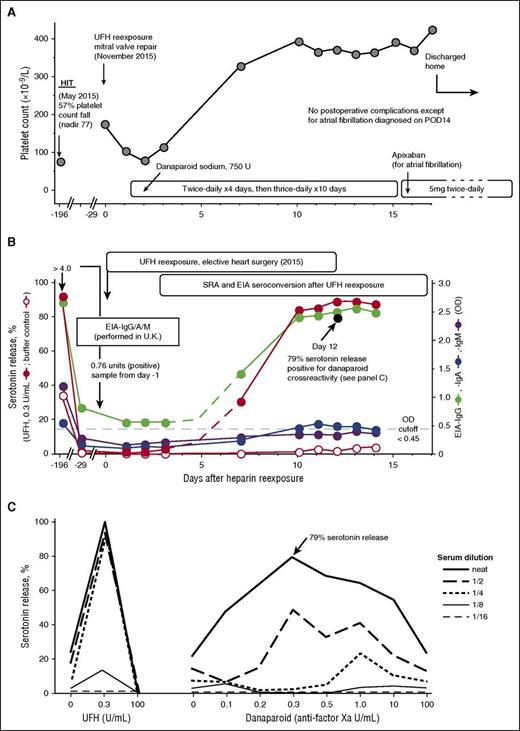 Figure 2. UFH reexposure for cardiac surgery in a patient with history of HIT who is now SRA negative but EIA-IgG positive. Patient 22 in Table 1. (A) Clinical summary. The patient had HIT in May 2015. UFH reexposure to permit mitral valve repair was performed in November 2015. The patient received postoperative anticoagulation with danaparoid sodium. The postoperative course was unremarkable except for atrial fibrillation (POD14), which was treated with subcutaneous danaparoid followed by oral apixaban (continued at discharge). (B) Serological summary (including seroconversion after reexposure). The patient tested strongly positive for HIT antibodies at HIT diagnosis, including EIA-IgG/IgA/IgM >4.00 OD units (PF4 Enhanced, Immucor GTI Diagnostics, Waukesha, WI), EIA-IgG (McMaster Platelet Immunology Laboratory) 2.67 OD units (90% inhibition by high heparin), and a positive SRA (peak serotonin release, 92% at 0.1 U/mL UFH, with 34% serotonin release at buffer control). At 24-week follow-up (day −29), the SRA tested negative (<10% serotonin release), but the EIA-IgG remained positive at 0.85 OD units (68% inhibition by high heparin). After reexposure to UFH, the patient developed repeat strongly positive seroconversion by SRA and EIA-IgG and weakly positive seroconversion by EIA-IgA. The buffer control reactivity in the SRA remained negative throughout the postoperative period. Later testing for danaparoid cross-reactivity (POD12 blood sample) showed a peak of 79% serotonin release in the presence of danaparoid (panel C). (C) Positive testing for danaparoid cross-reactivity. POD12 serum was later tested for danaparoid cross-reactivity; patient serum-induced serotonin-release at buffer control (ie, at 0 U/mL UFH) was weakly positive (21% release), which increased to a peak of 79% serotonin release at 0.3 anti-factor Xa U/mL (final) danaparoid, thus confirming in vitro cross-reactivity.